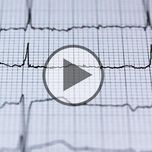 Vorhofflimmern - die häufigste Herzrhythmusstörung - Video