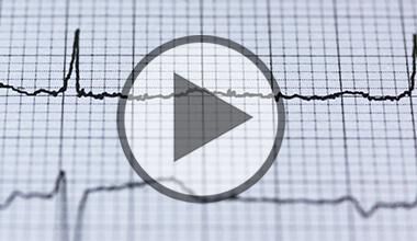 Vorhofflimmern - die häufigste Herzrhythmusstörung - Video