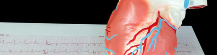 Herzstillstand: Herzfrequenz bei pulsloser elektrischer Aktivität (PEA) als starkes Prognose-Tool