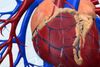 Kardiologie wird immer besser, doch das Herz-Kreislauf-Problem bleibt bestehen
