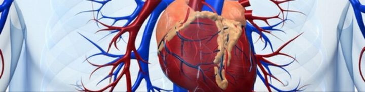 Kardiologie wird immer besser, doch das Herz-Kreislauf-Problem bleibt bestehen