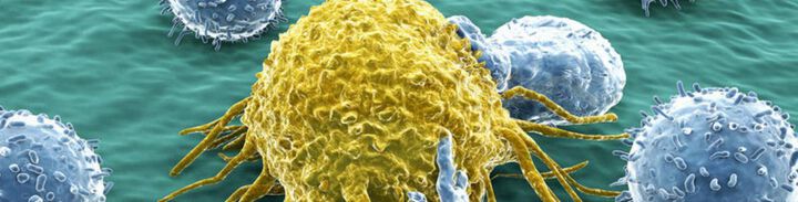 Kampf gegen Krebs: Höhere Investitionen und weltweite Strukturmaßnahmen gefordert