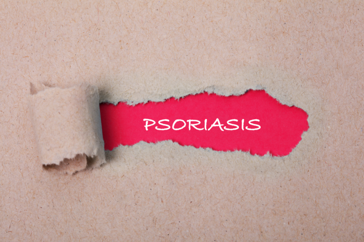 Neuer Langenscheidt zu Psoriasis