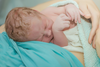 Per Kaiserschnitt geborene Kinder haben höheres Erkrankungsrisiko
