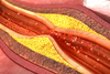 Sirtuine: Eine vielversprechende Therapieoption bei Verschlusskrankheiten der Blutgefäße