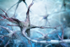 MS: Stammzelltransplantation verringert Entzündungen bei Gehirnzellen