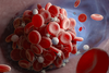 Welt-Thrombose-Tag am 13. Oktober: Thrombosen sind zweithäufigste Todesursache bei Krebs