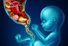 Fettreiche Ernährung der Mutter schadet Gehirn von Ungeborenen