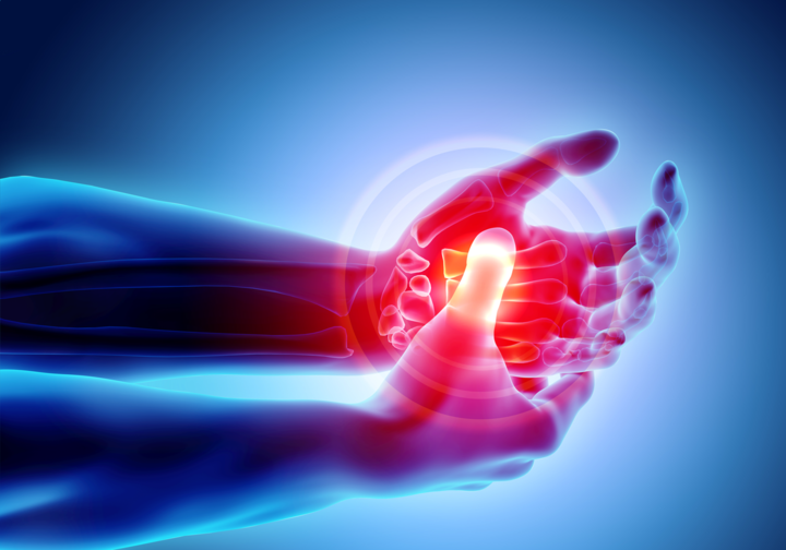 Rheumatoide Arthritis: Arginin als Ansatzpunkt für mögliche Therapien