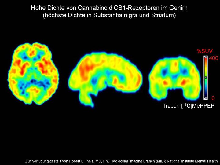 Erstmals nachgewiesen: zugelassenes Cannabinoid lindert Symptome bei Parkinson