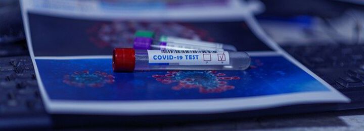 Coronavirus: Doppelte Vorsicht rund um Massentests geboten