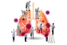 COVID-19 und das Risiko für anhaltende Lungenveränderungen