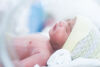 Studie zeigt Verbesserungspotenzial bei Versorgung Frühgeborener auf