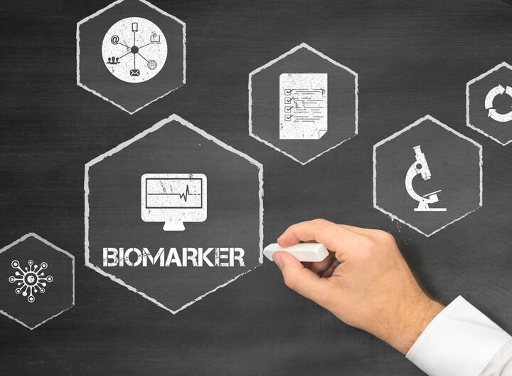 Neuer Biomarker zur frühzeitigen Vorhersage für das Ansprechen auf CAR-T-Zell-Therapie