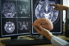 Ein wichtiger Blick ins Hirn: MRT-Untersuchungen können das Risiko von Hirnblutungen aufzeigen