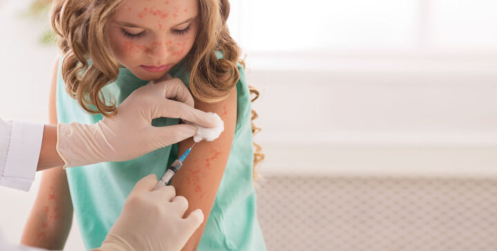 Masernwelle: ÖÄK-Experten rufen zum Impfen auf