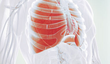 COPD ist oft die Folge von chronischem Bronchitis, Asthma bronchiale und Emphysem.