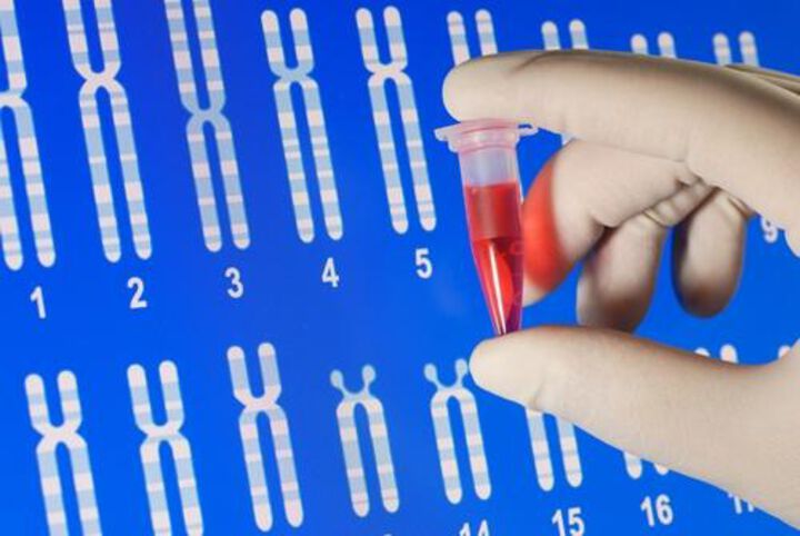 Forscher entdecken Gen für seltene Darmkrebsvariante