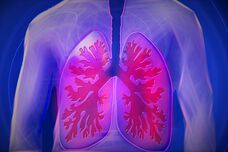 Medikamente können den Verlauf der idiopathischen Lungenfibrose verlangsamen. Ein Interview.