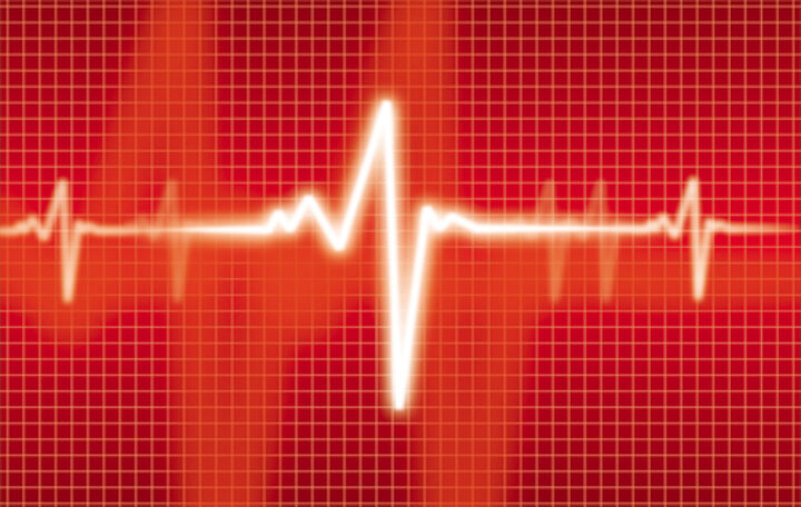 Defekte Ionenschleuse für Herzrasen verantwortlich 