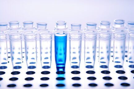 Хора с хепатит В или С са по-застрашени да развият паркинсон