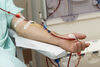 Пациенти на хемодиализа в Ямболско се транспортират при мизерни и опасни условия 