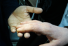 Над 30 пациенти преминаха през безплатните прегледи за гъбички по ноктите

