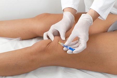 Stvolovi Kletki Pri Osteoartrit Obeshavasha Terapiya Ili Izmama Credoweb