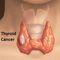 Новости в комплексното лечение на щитовидния карцином