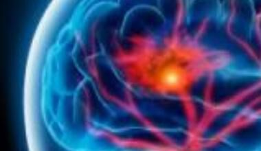 УМБАЛ „Св. Анна“ ще е домакин на симпозиум „Съвременно поведение при мозъчни инсулти” 