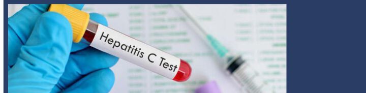 Попитайте за безплатния тест за Хепатит C в "ЛИНА" - Варна