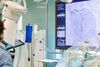 
Спасиха пациент с инфаркт на червата чрез инвазивна аспирация на тромб в Болница „Тракия“
