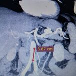 Робота Да Винчи спаси живота на 70-годишна с напреднал рак на право черво 
