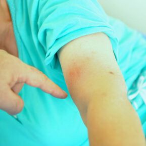 Близо 150 души консултирани безплатно във ВМА за лаймска болест