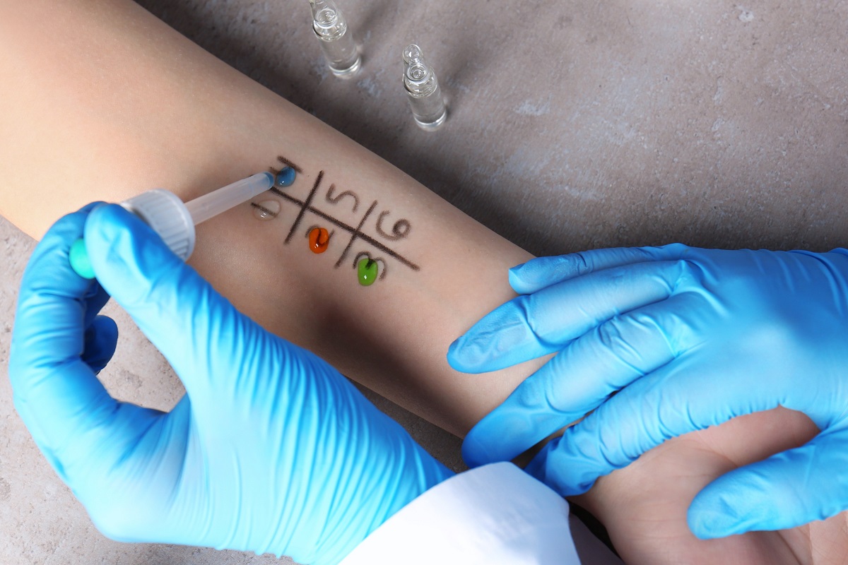 тестуване за алергии е златен стандарт