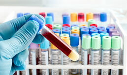 Кампания по кръводаряване сред депутати