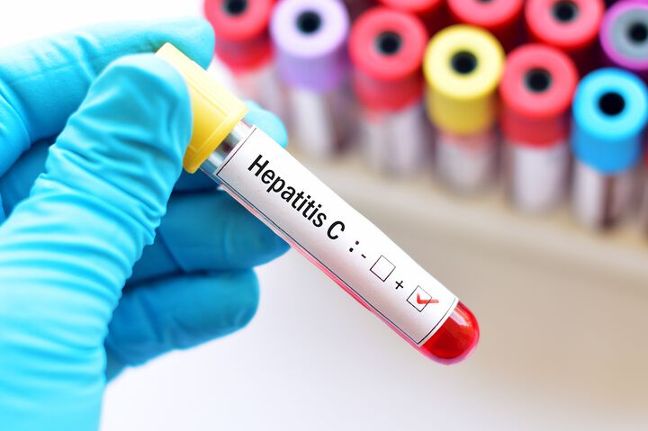 Кръвните центрове ще уведомяват дарителите, заразени с хепатит