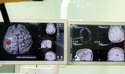 Клиниката по неврохирургия на ВМА с най-съвременната невронавигационна система