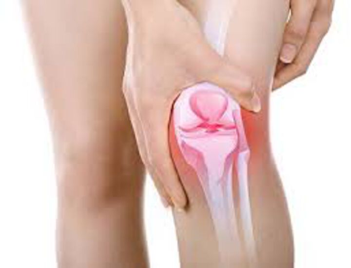Болката в коляното ми артрит ли е или скъсан менискус?