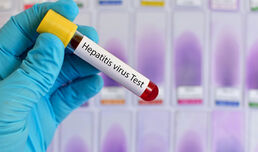 Безплатни изследвания за Хепатит C и B