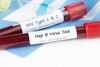 Безплатни тестове за хепатит и СПИН 