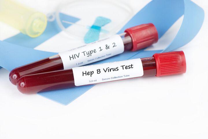 Безплатни тестове за хепатит и СПИН 