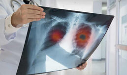 Ново ръководство по белодробни болести - второ съгласуване