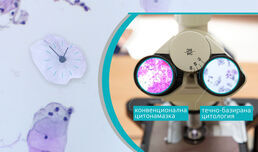 Цитонамазката: Първата и най-важна стъпка в предотвратяването на рака на маточната шийка 