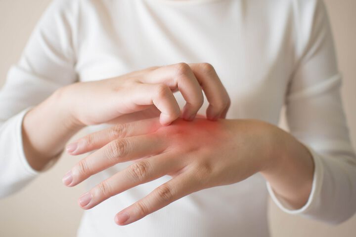 60% от болните от атопичен дерматит се излекуват напълно