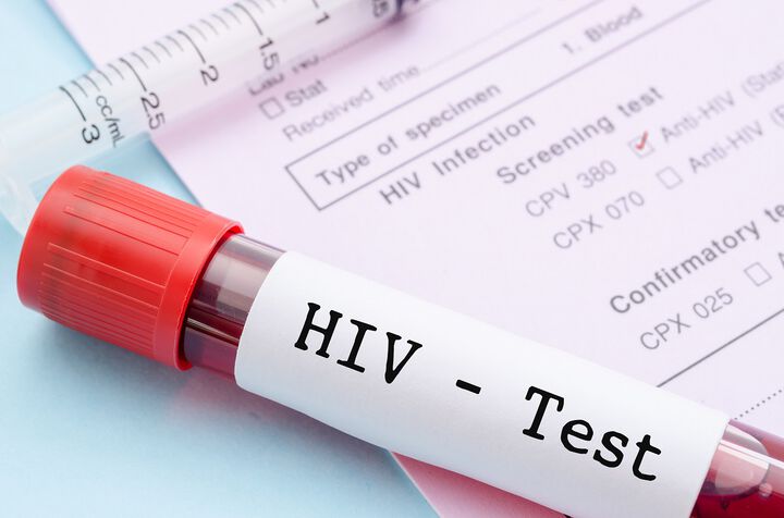 Нови 28 случая на ХИВ са регистрирани у нас от началото на годината