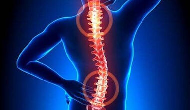 Основни причини защо болката в гърба е трудно да бъде диагностицирана