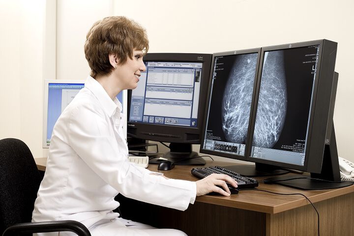 Д-р Силвия Йорданова, рентгенолог: Първи преглед за рак на гърдата за жени на 30 г.