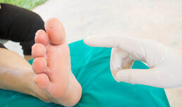 Раните при диабетно стъпало са най-често на пръстите и глезените