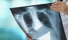 Трайно намалява броят на болните от туберкулоза в страната